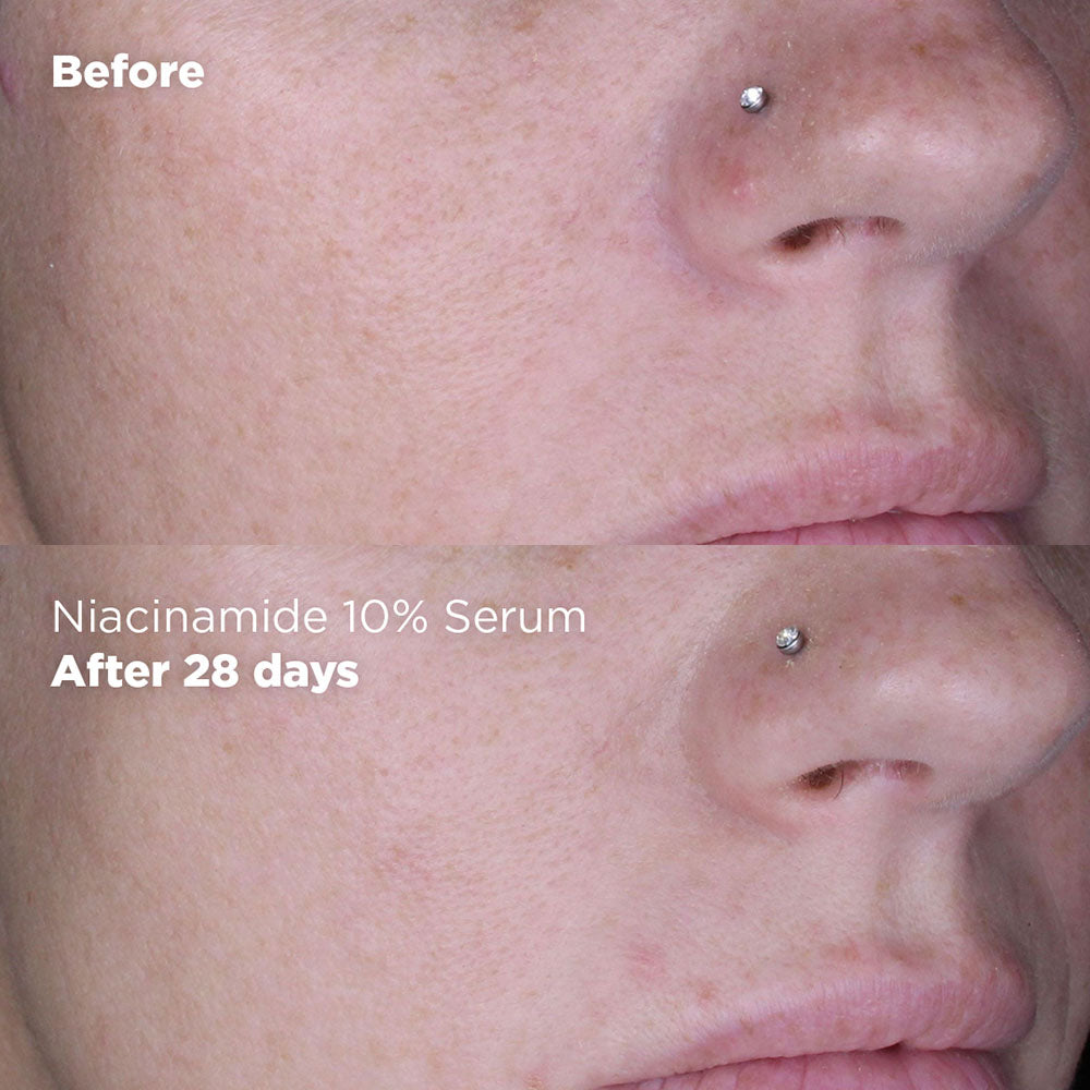 Niacinamide 10% Serum 30ml